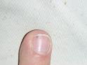 The Nail Splinter
